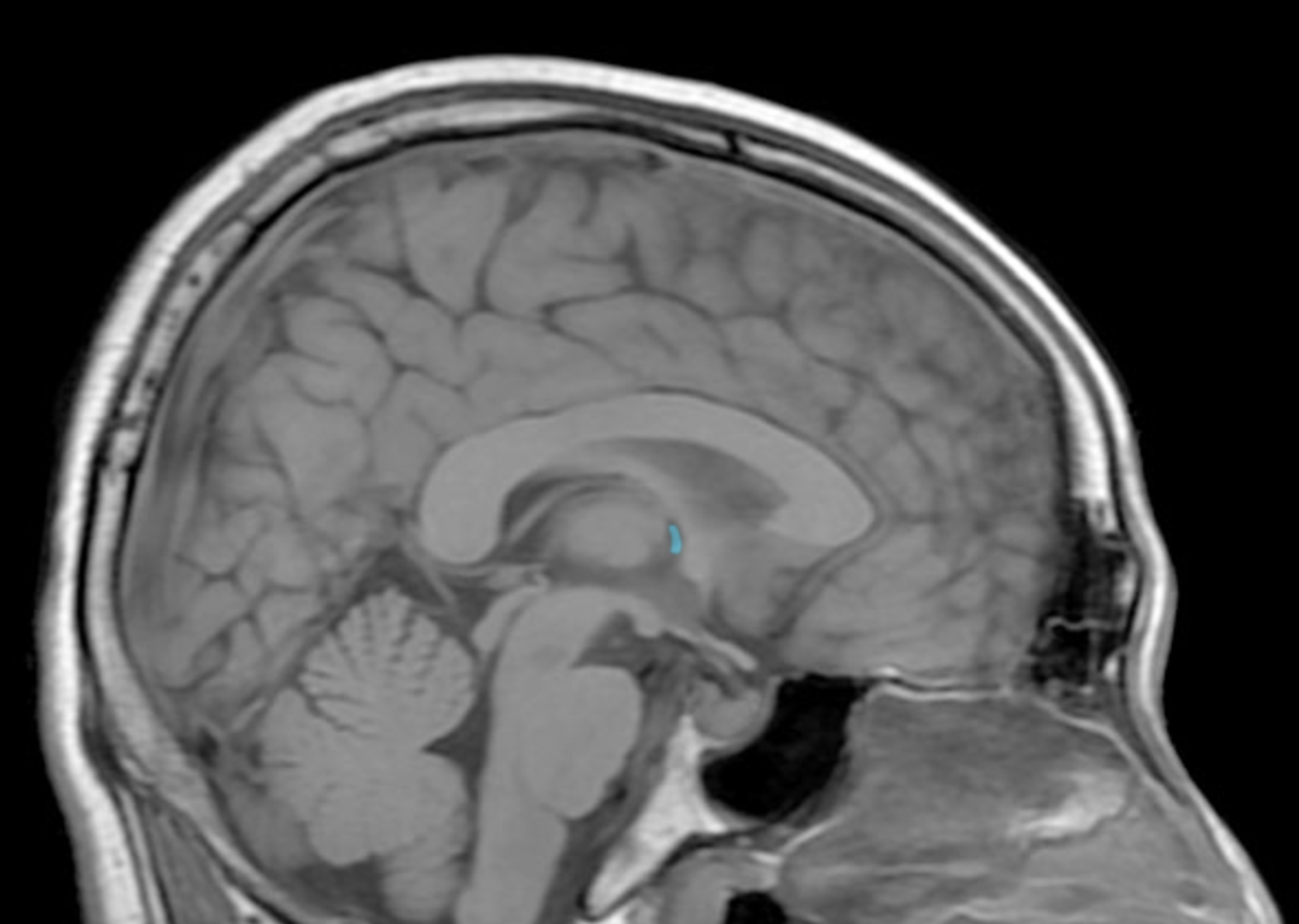 term image