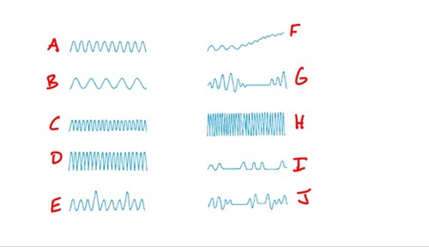 <p>E</p>