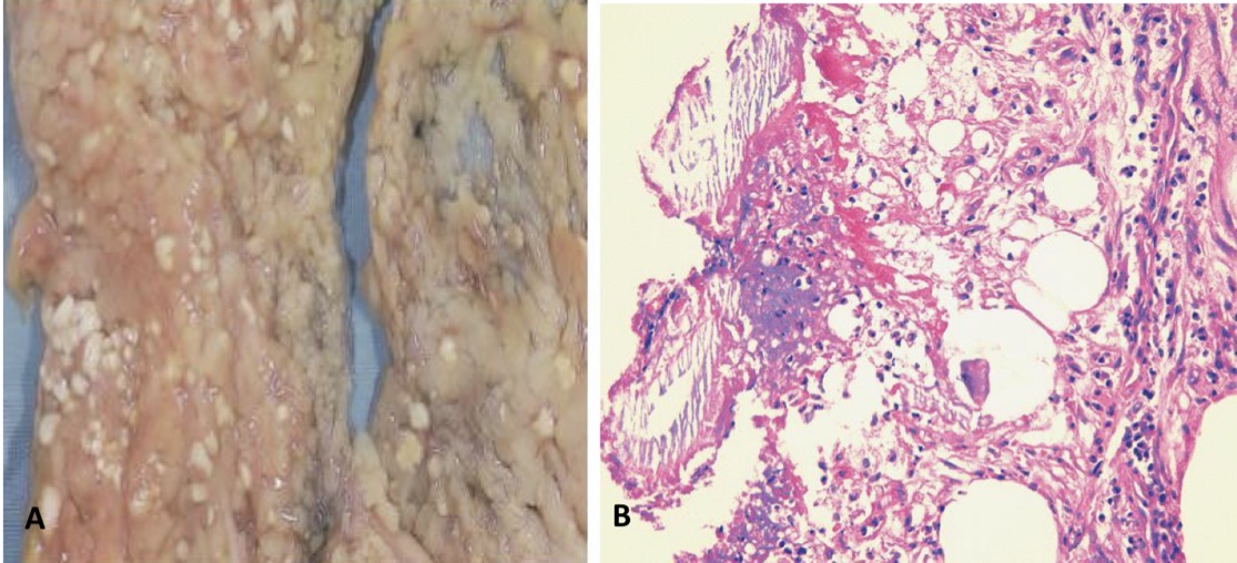 <p>A- identify</p><p>B- Describe A&amp;B</p>