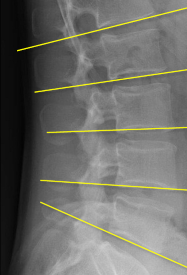 <p>Q what is the name of this measurement? and what is the average + range?</p>