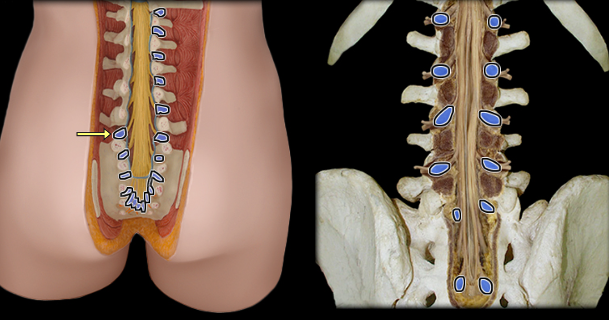 <p>Dorsal root ganglion</p>