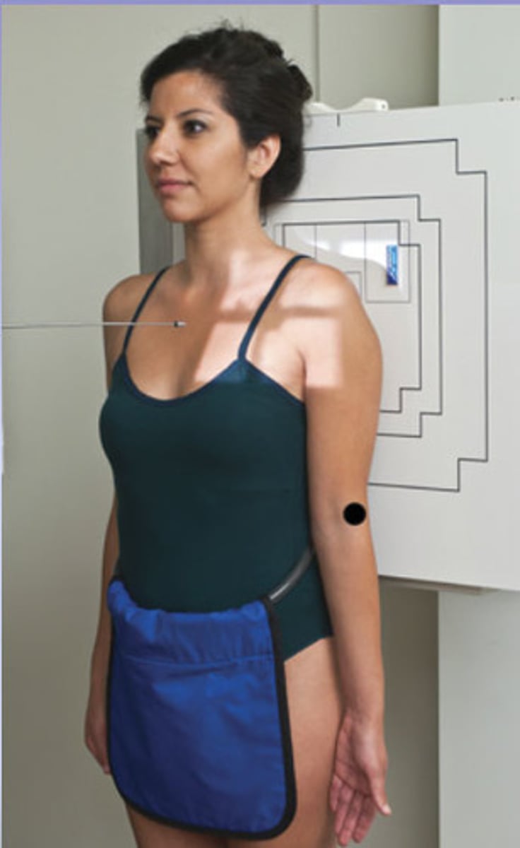 <p>perpendicular and directed 1 inch below coracoid process</p>