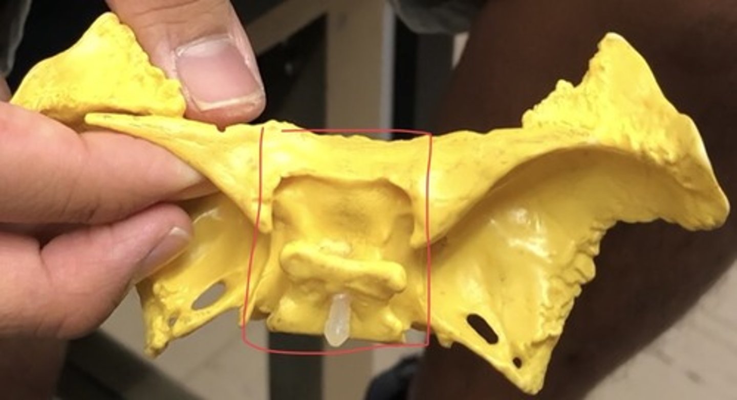 <p>center; portion of sphenoid that does not include wings</p>