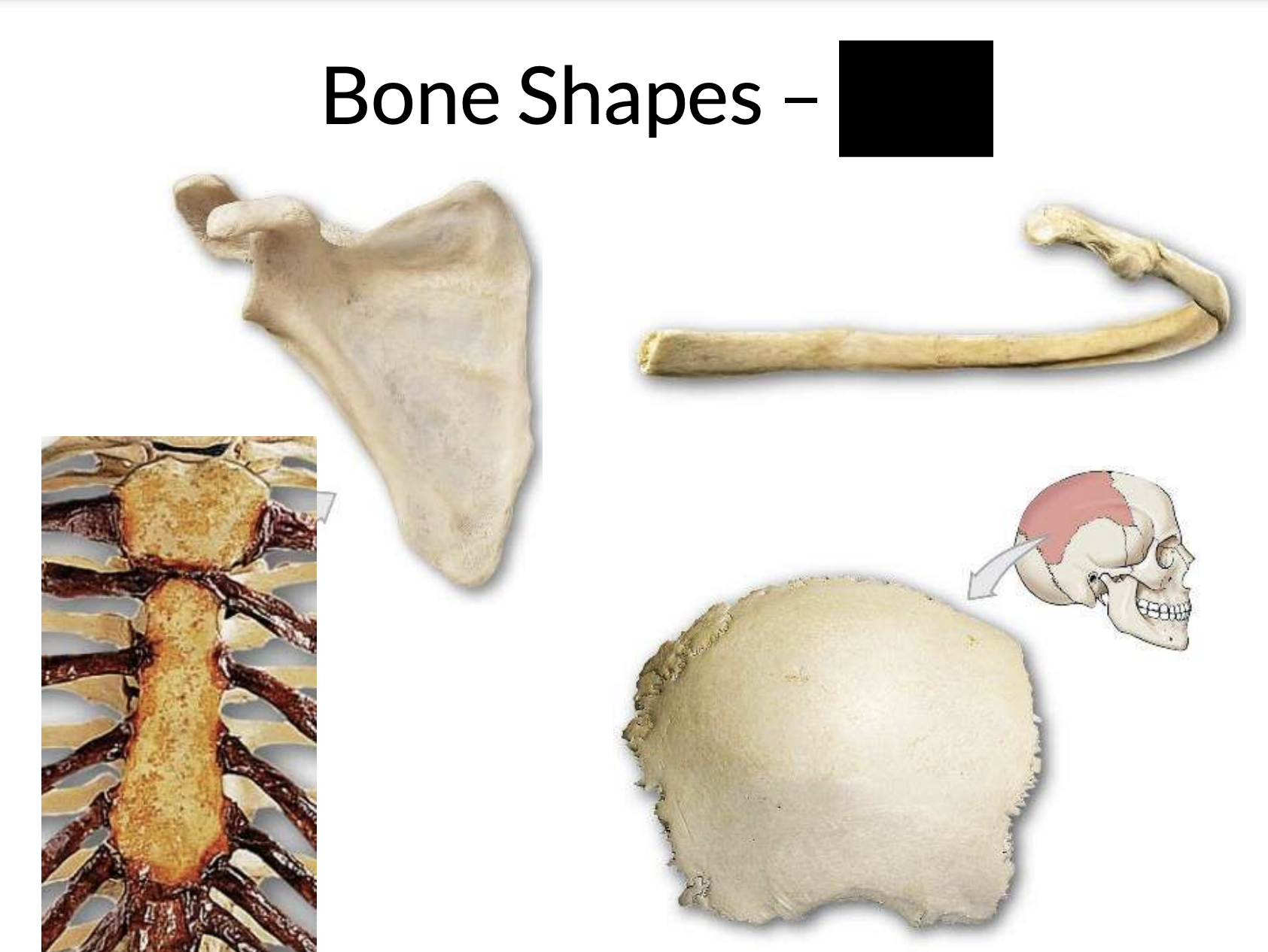 What bone shape is this?