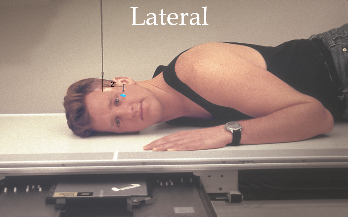 <ul><li><p>2 inches superior to EAM</p></li><li><p>Interpupillary is perpendicular</p></li></ul><p></p>