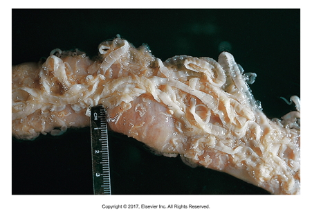 <ul><li><p>Affects: Dog​s</p></li><li><p>Adults in small intestine​</p></li><li><p>Intermediate hosts: Rabbits and hares (T. pisiformis), ruminants (T. hydatigena), sheep (T. ovis)​</p></li><li><p>Cause of infection: Ingestion of intermediate host​</p></li><li><p>1-2 cm (T. ovis) to 200 cm (T. pisiformis) to 500 cm (T. hydatigena)​</p></li><li><p>Armed scolex, motile gravid proglottids– if found in feces, hydrate​ in saline on slide to see eggs inside​</p></li><li><p>Single lateral pore</p></li><li><p>T. pisiformis has pea sized cysticercus, attached to greater omentum of rabbit​</p></li><li><p>T. hydatigena has ping pong ball sized cysticercus, attached to greater omentum of ruminant​</p></li><li><p>T. ovis has cysticercus found in muscle of sheep ​</p></li><li><p>Preventing dogs and cats from eating viscera or musculature of intermediate hosts is best way to prevent Taenia infections</p></li></ul><p></p>