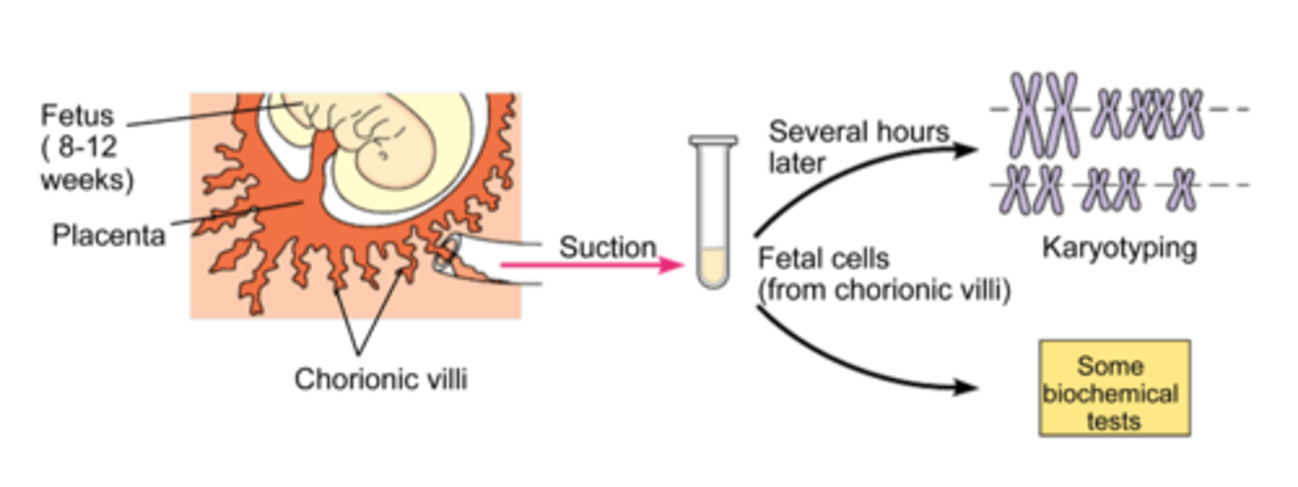 <p>sampling of placental tissues for prenatal diagnosis. Can be done earlier than amniocentesis</p>