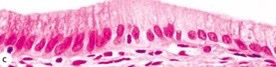 What type of epithelia?