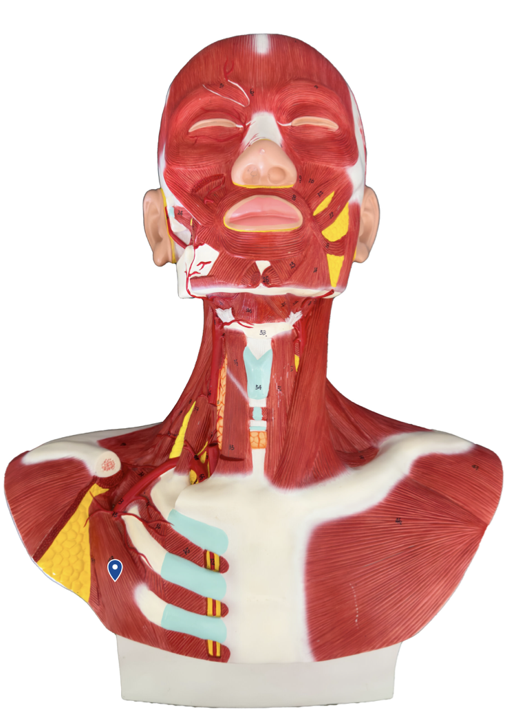 <p>What muscle is the arrow pointing to?</p>