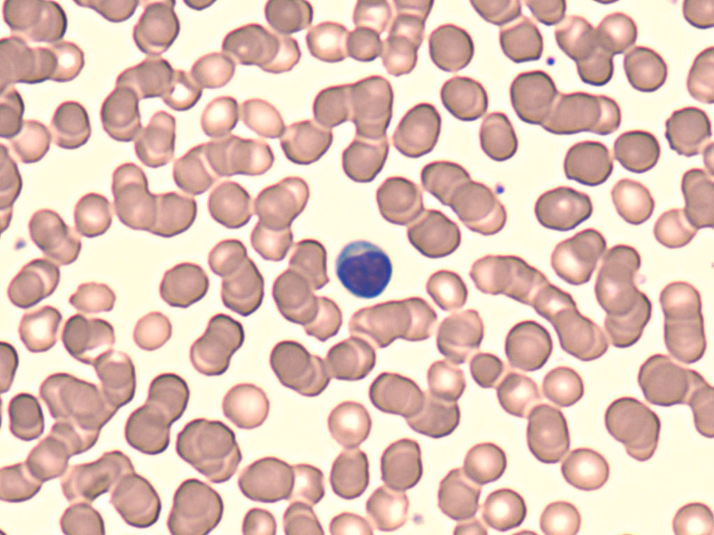 <p>lymphocytes</p>
