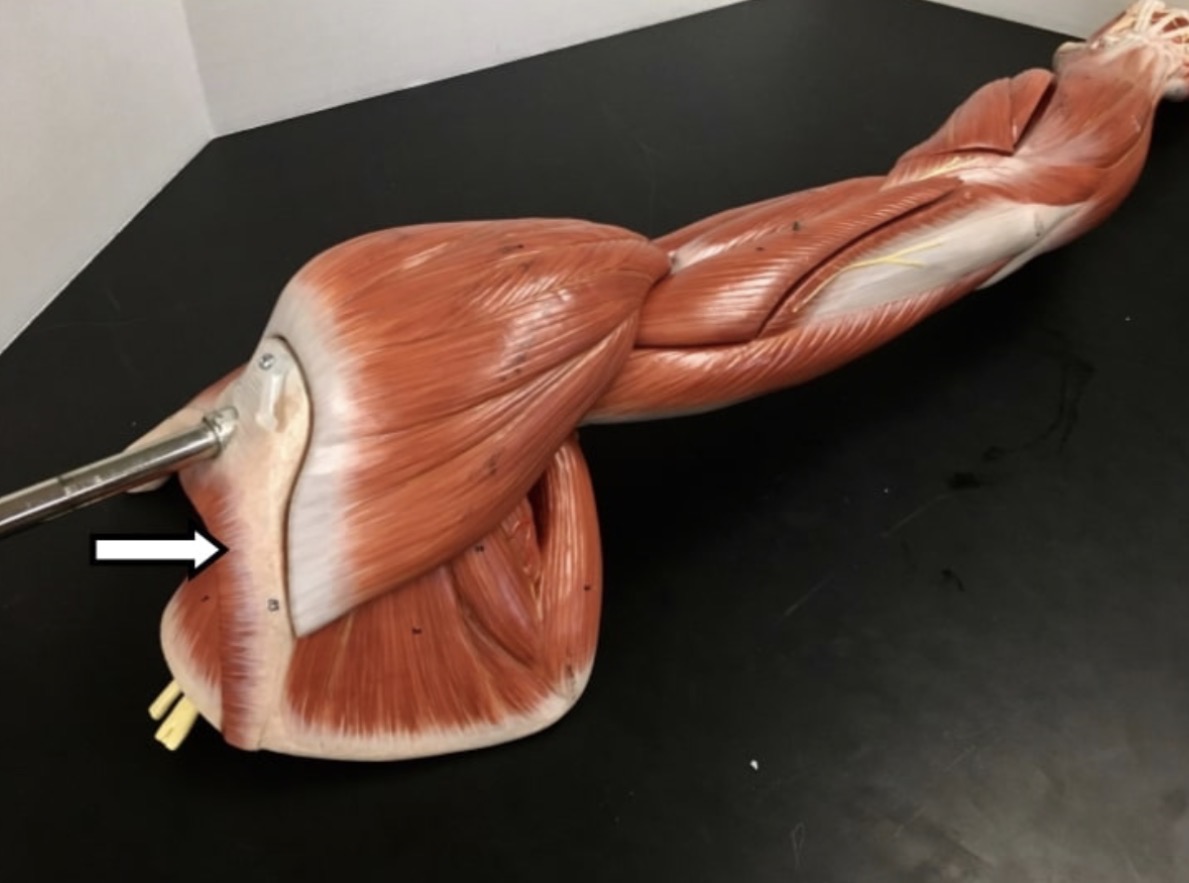 <p>Name one muscle that has its origin from the process pointed with the arrow and name one action. </p>