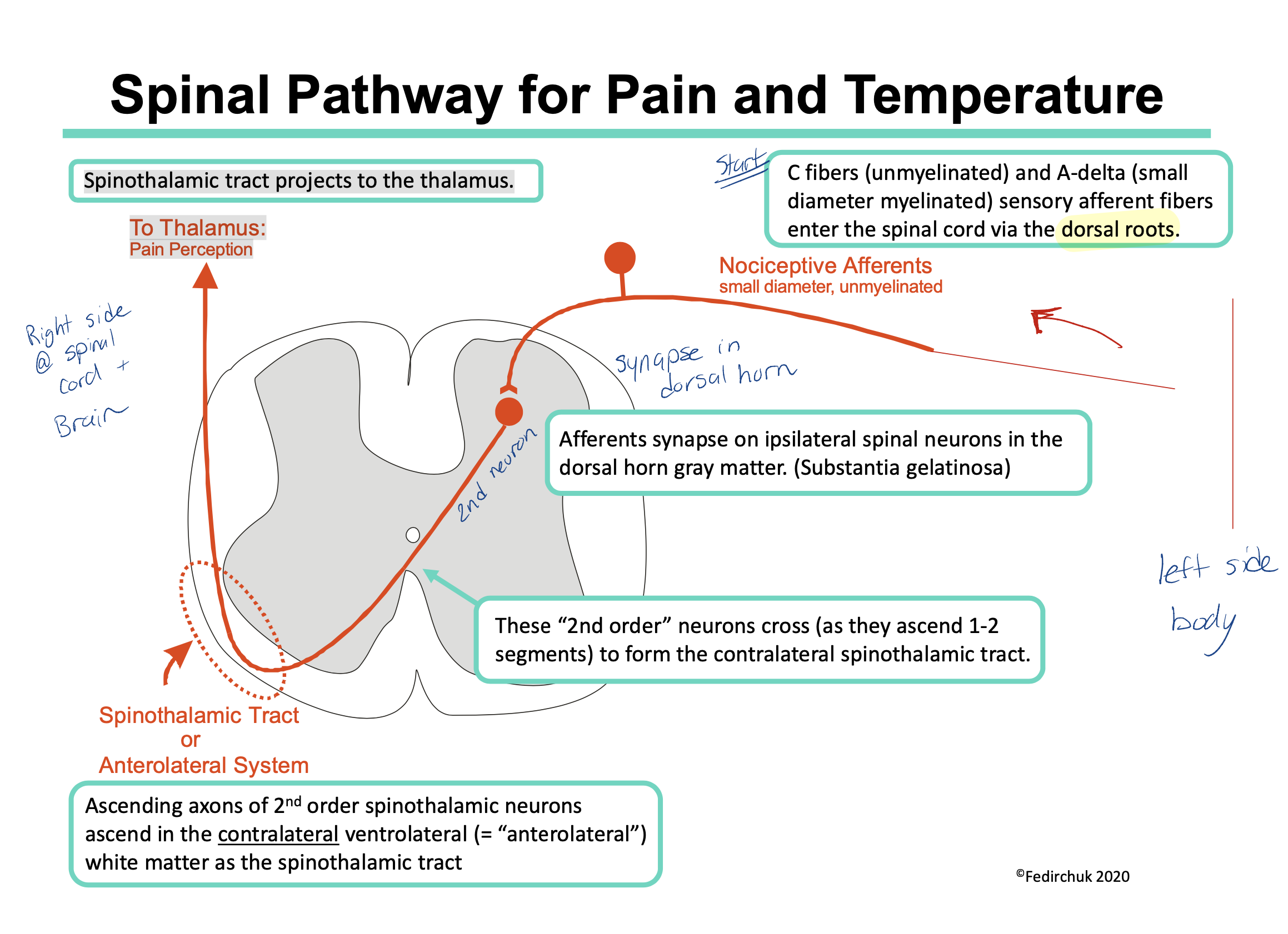 <ol><li><p><span>C fibers (unmyelinated) and Type A‐delta fibers (small diameter myelinated) enter the spinal cord via the dorsal roots</span></p></li><li><p><span>They synapse on same side they enter the spinal cord (ipsilateral) in the dorsal horn gray matter. (Substantia gelatinosa)</span></p></li><li><p><span>The 2nd neuron now crosses (during the length of 2 spinal segments) and the signal travels up on the opposite side of the body via the spinothalamic tract.</span></p></li><li><p><span>Spinothalamic tract projects to the thalamus.</span></p></li><li><p><span>thalamus to somatosensory cortex in brain </span></p><p></p><p>Note: a sensory input from the left side of the body will be processed in the right side of the brain (and vice versa) </p><p></p></li></ol>