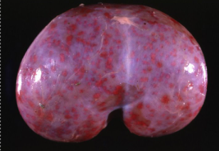 <p>Causative agent of this petechial haemorrhage on a dogs kidney</p>
