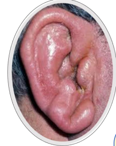 <p>What is this disorder</p>