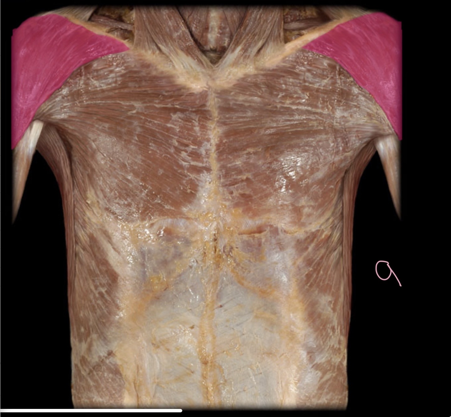 <p>Deltoid</p>
