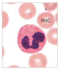 <p>What White Blood Cell is being displayed?</p>