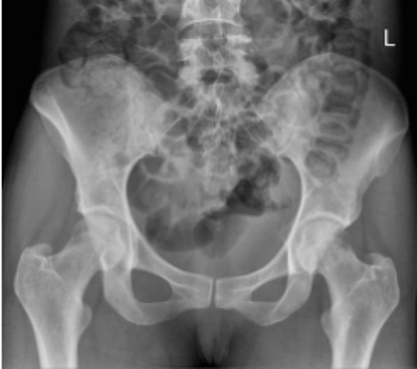 <p>What is the name of the radiographic view?</p>