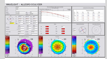 <ul><li><p>Irregularity Index (SRI)</p></li><li><p>Surface Asymmetry Index (SAI)</p></li></ul><p></p>