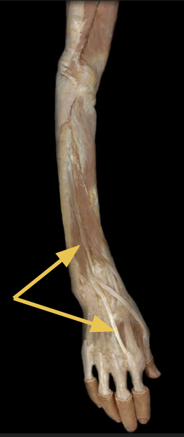 <p>identify + state origin, insertion, action, innervation of marked structure</p>