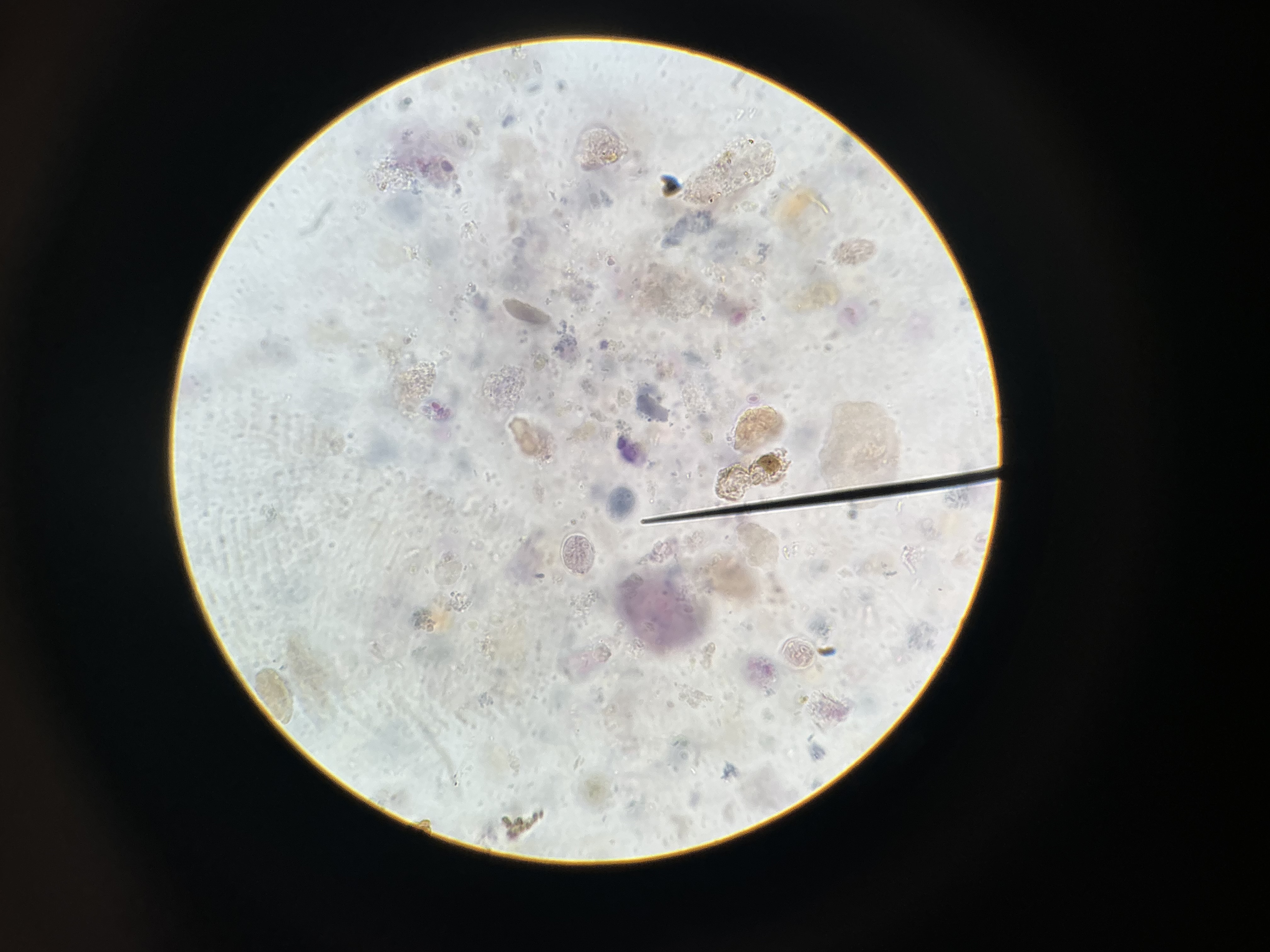 <p>Giardia lamblia (intestinalis) trophozoite</p>