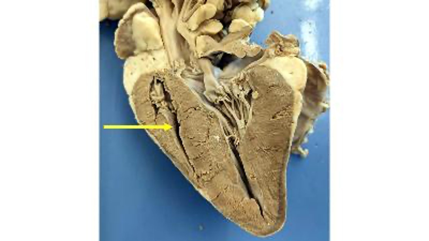 <p>Name the membrane</p>