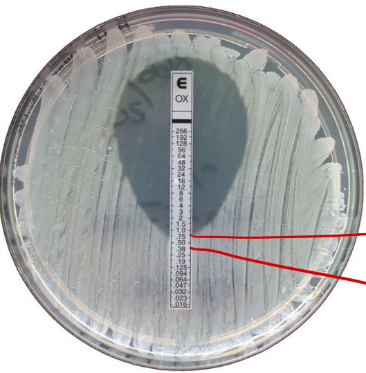 <p>What test is shown in the image?</p>