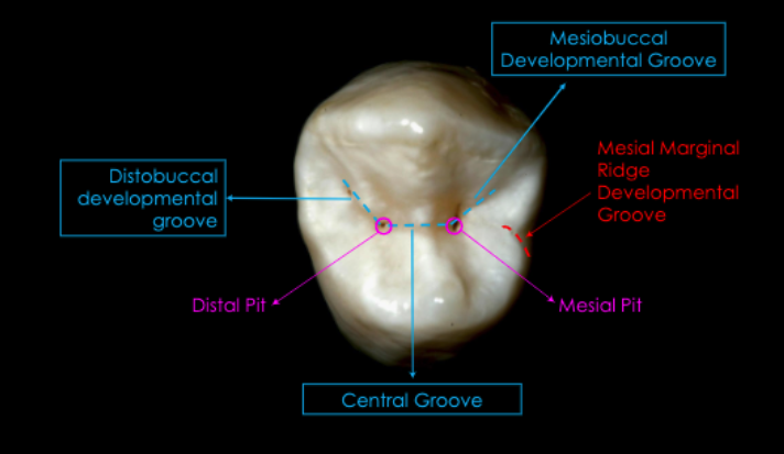 <p>distobuccal developmental groove<br>mesiobuccal developmental groove<br>central groove</p><p>mesial marginal ridge developmental groove</p>