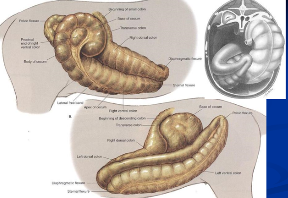 <p><span style="background-color: transparent;">Dorsal Displacement of Large Intestine</span></p>