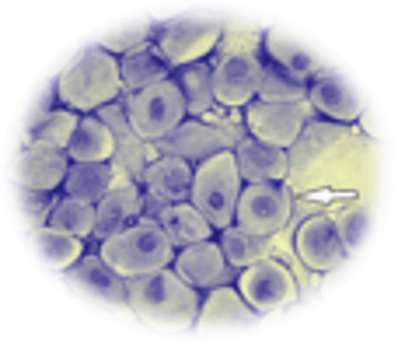 <p></p><ul><li><p>Plump round <strong><u>parabasal </u></strong>cells (&amp; intermediate cells = not as round)</p></li><li><p>Contain RBCs &amp; neutrophils (due to seroanguinous discharge)</p></li></ul><p></p>