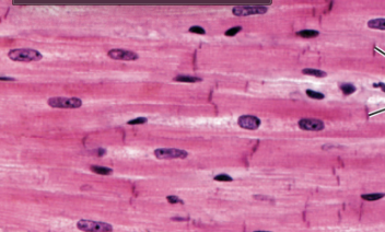 <p>What Muscle Tissue is this?</p>