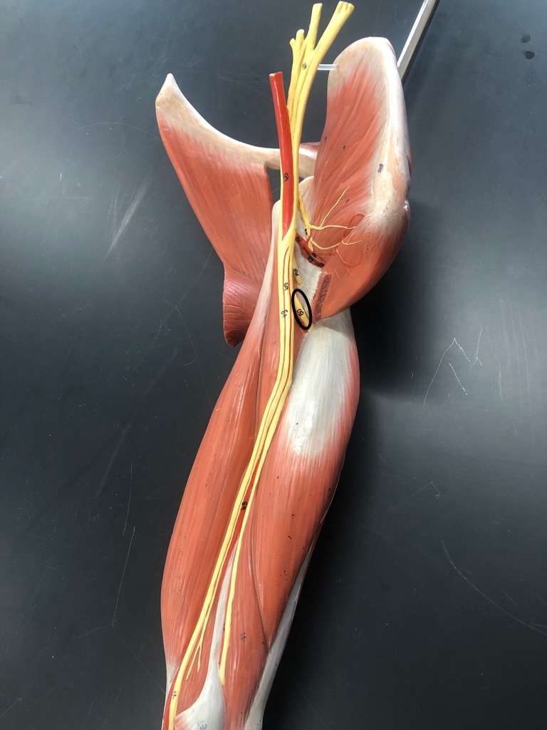<p>What muscle is this?*****</p>