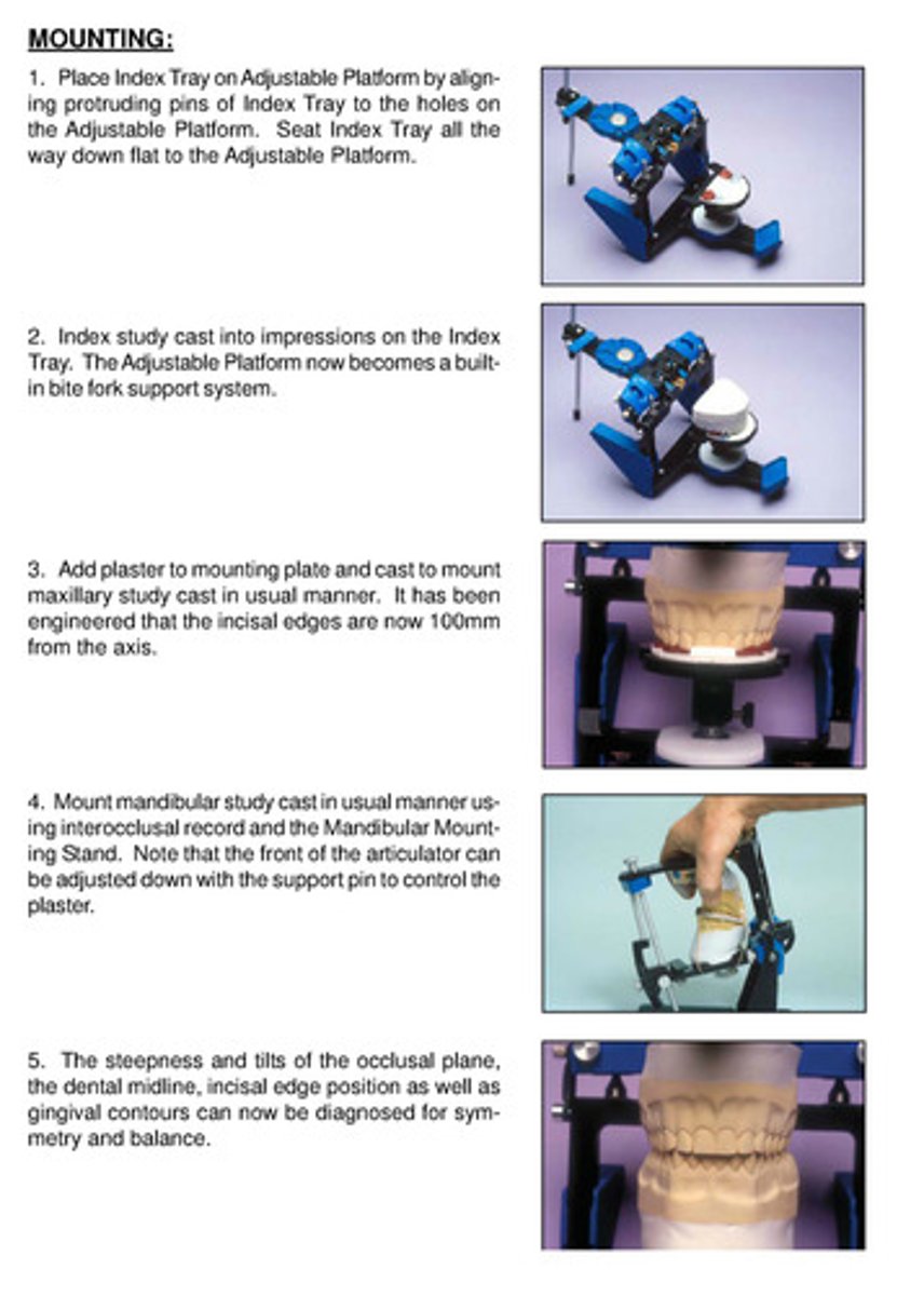 <p>after maxillary cast is mounted, it has been engineered that the incisal edges are now 100 mm from the axis!</p>