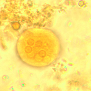 <p>Entamoeba coli cyst</p>