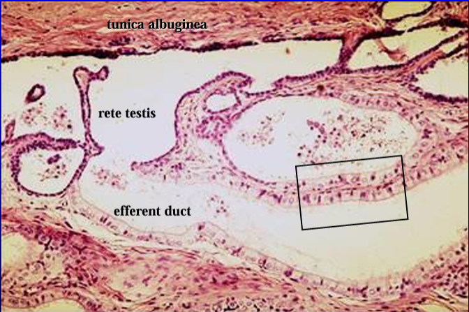 <p>Another view of the r<strong>ete testis connecting with the efferent ducts. </strong></p><p>Notice the change in the height of the epithelium which lines the rete testis (low cuboidal) to that which lines the efferent ducts (columnar).</p>