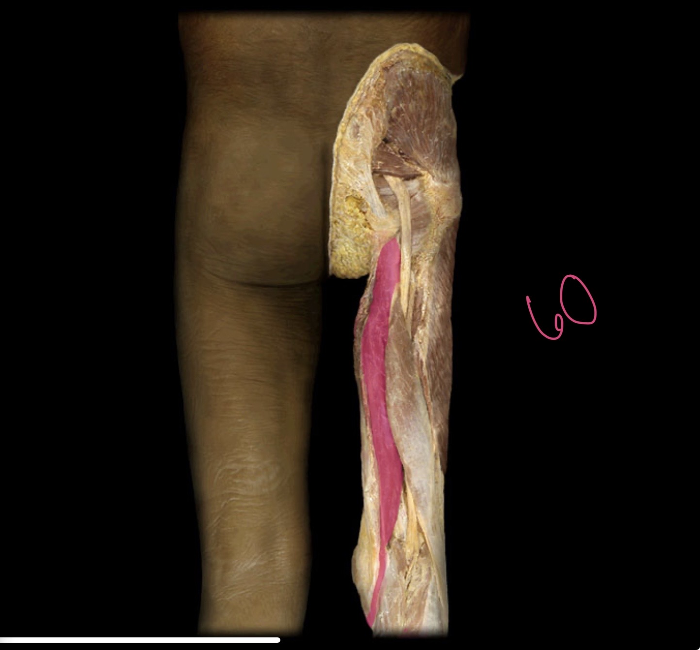 <p>Semitendinosus</p>
