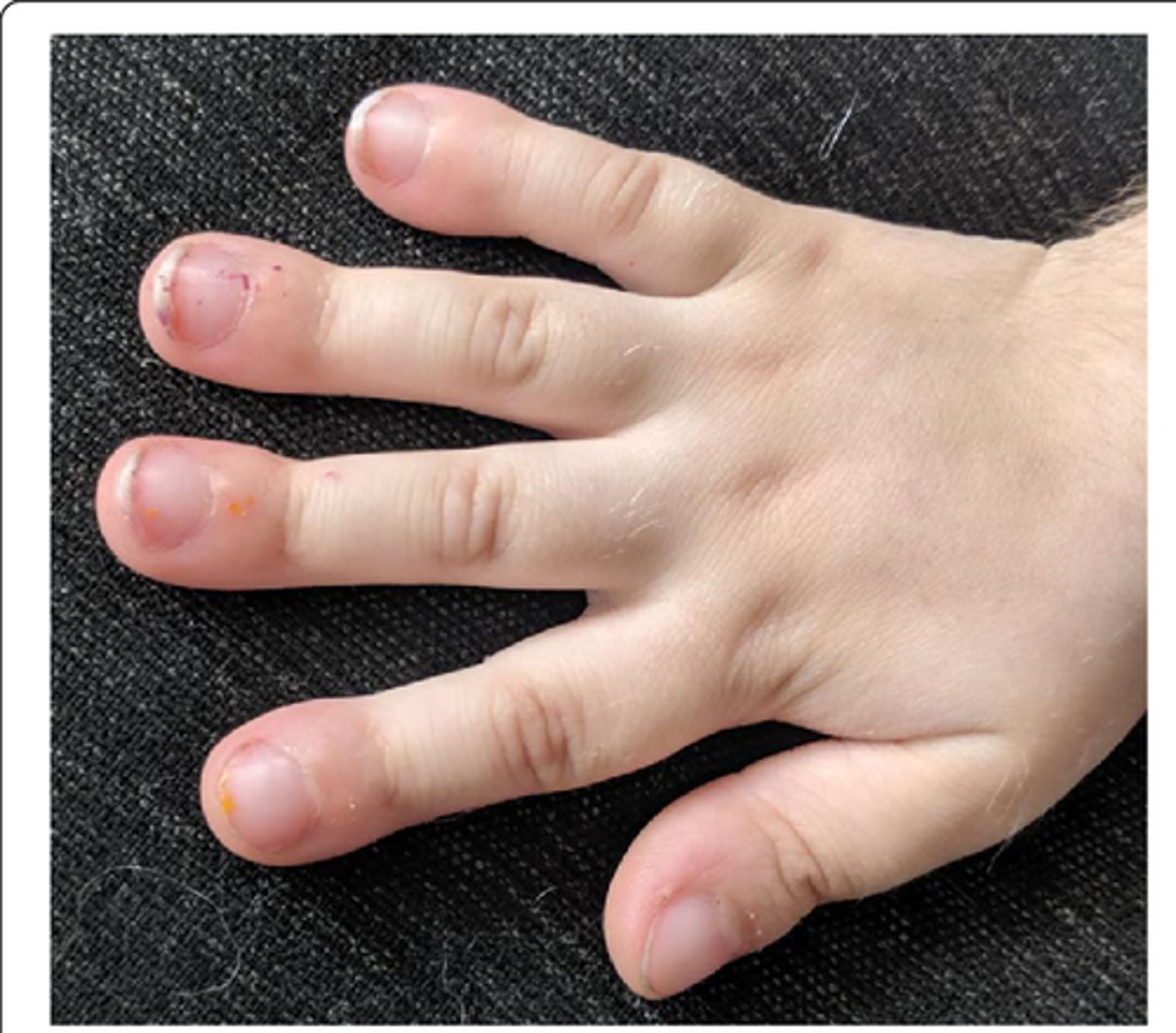 <p>this picture indicates:</p>