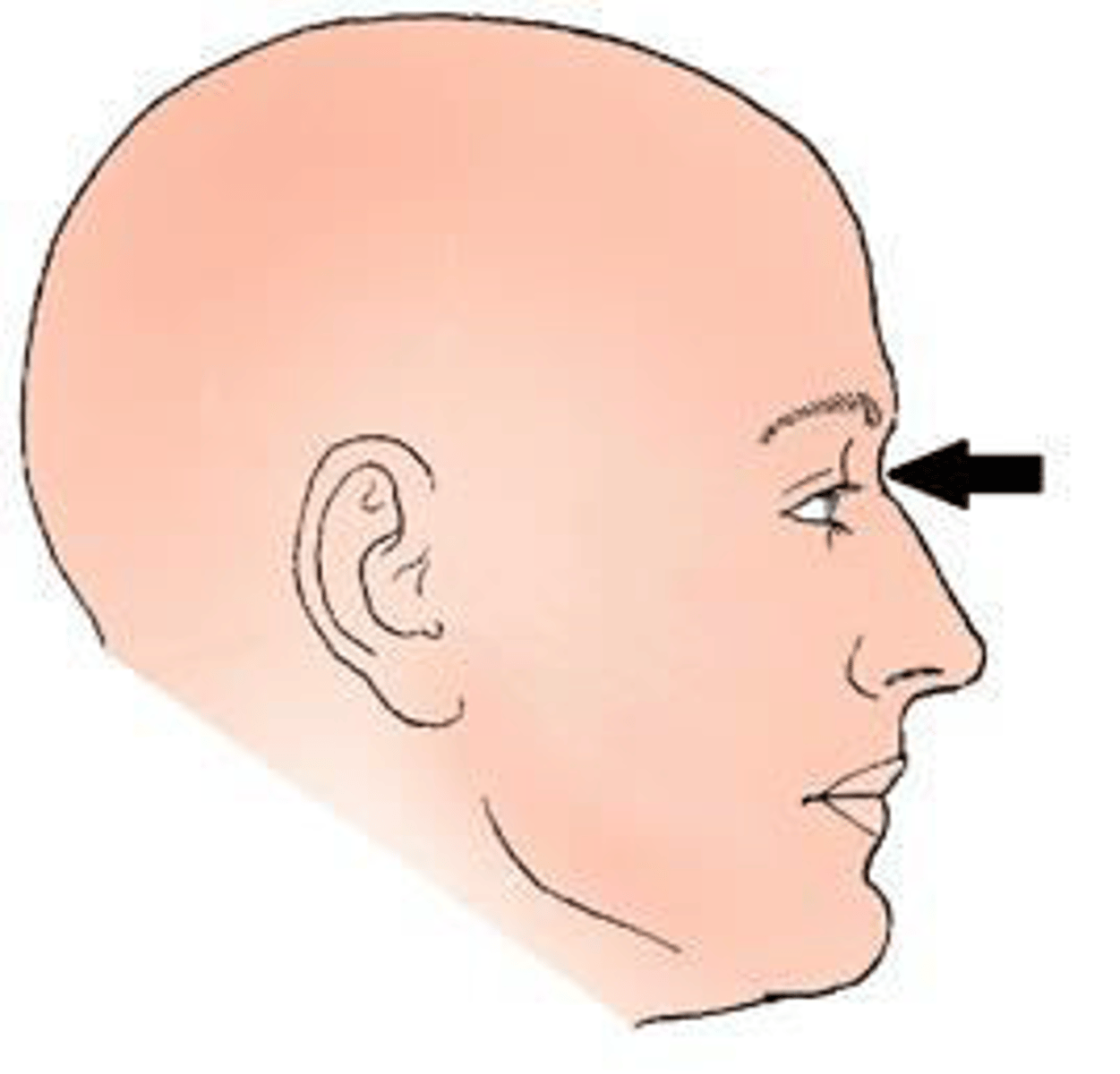 <p>a. nasion.</p><p>3 multiple choice options</p>