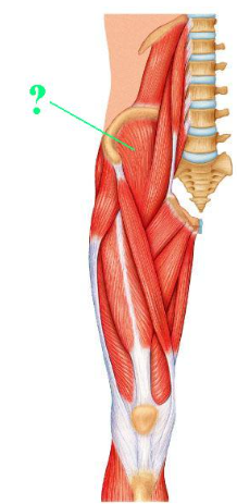 <p><span>Identify the indicated muscle.</span></p>