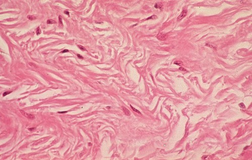 <p>Dense Irregular Connective Tissue — Location</p>