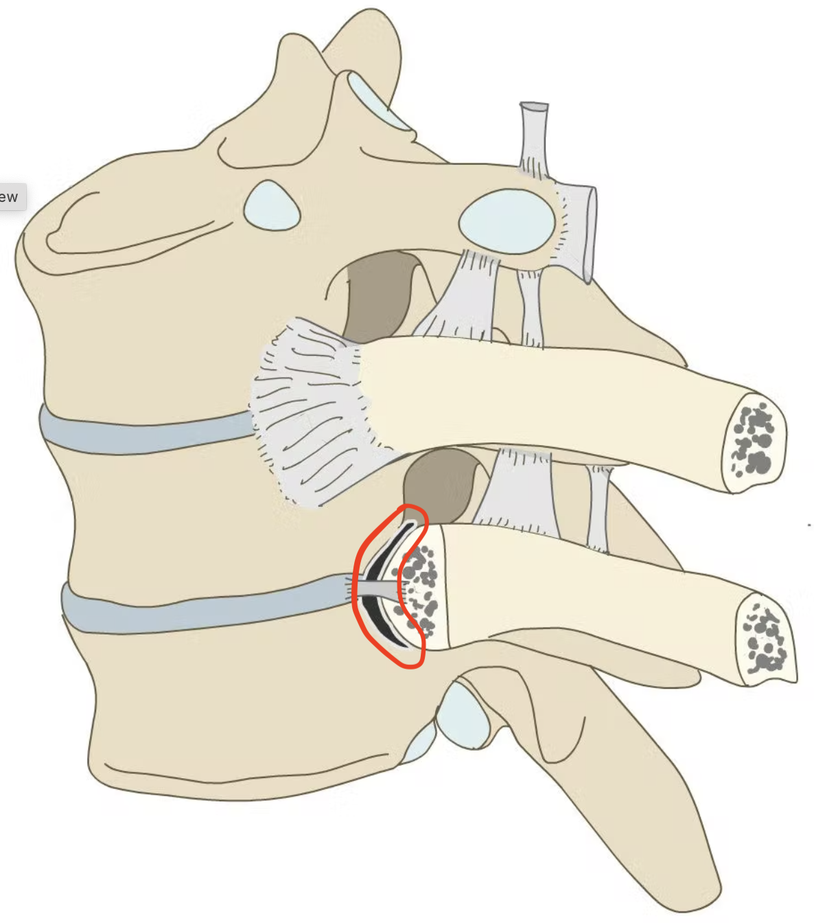 synovial plane (diarthrosis arthrodial) joint, stabilizes costocentral joint, collagen fibers from capsular igament extend into thoracic IVF giving small contribution to anterior boundary of IVF