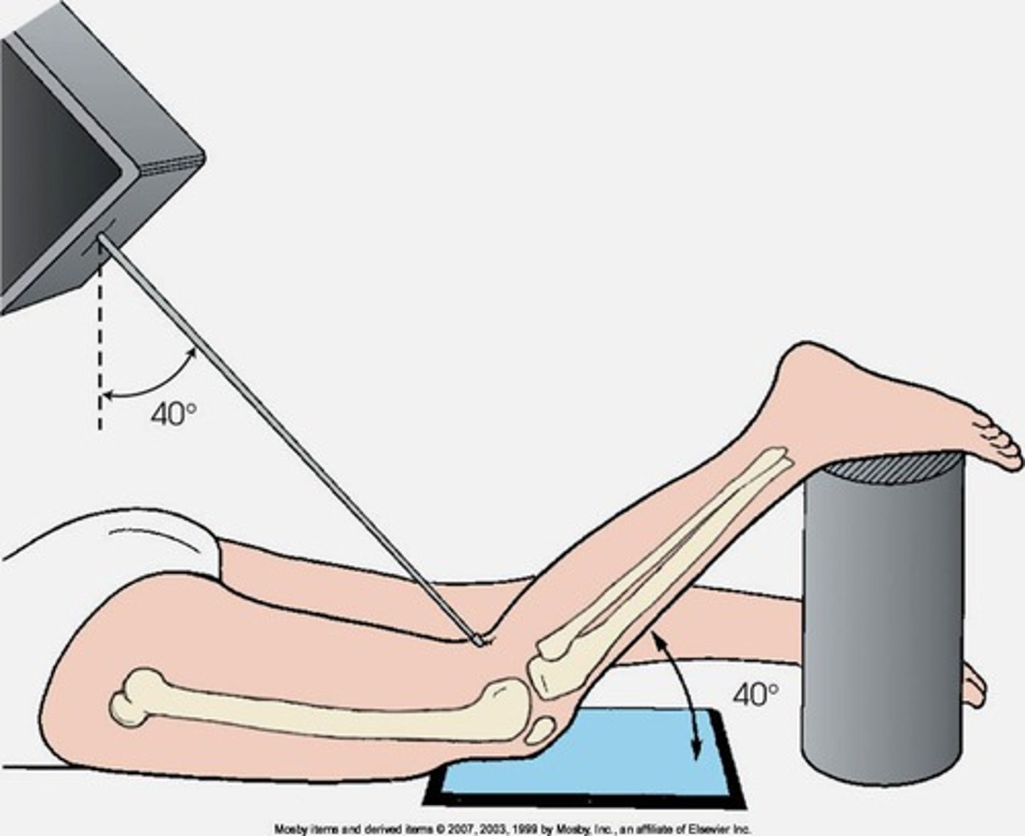 <p>projection for the intercondylar fossa in profile</p><p>pt in prone position and knee flexed 40-50 degrees </p><p>CR perpendicular to lower leg 40-50 degrees caudad</p>