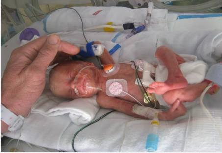 <p>Birth before __ weeks is considered premature </p>