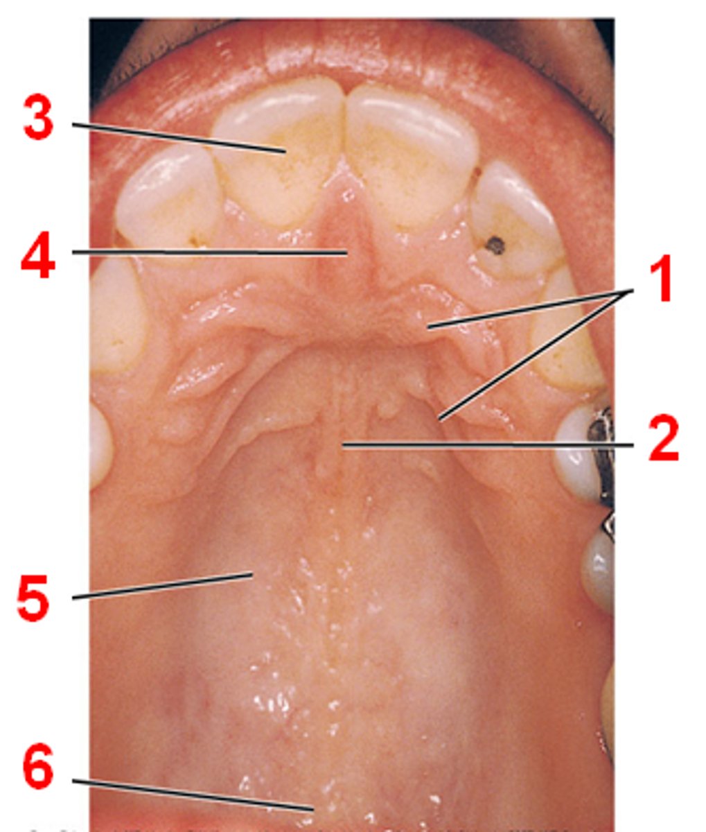 <p>identify parts of the palate</p>
