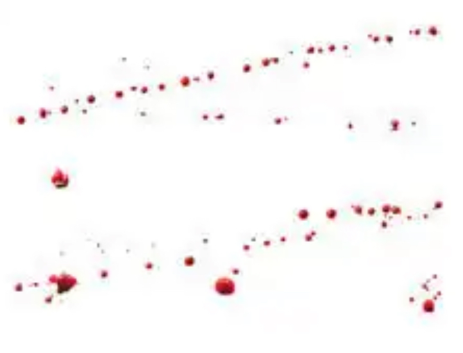 <p>What cause this blood stain</p>