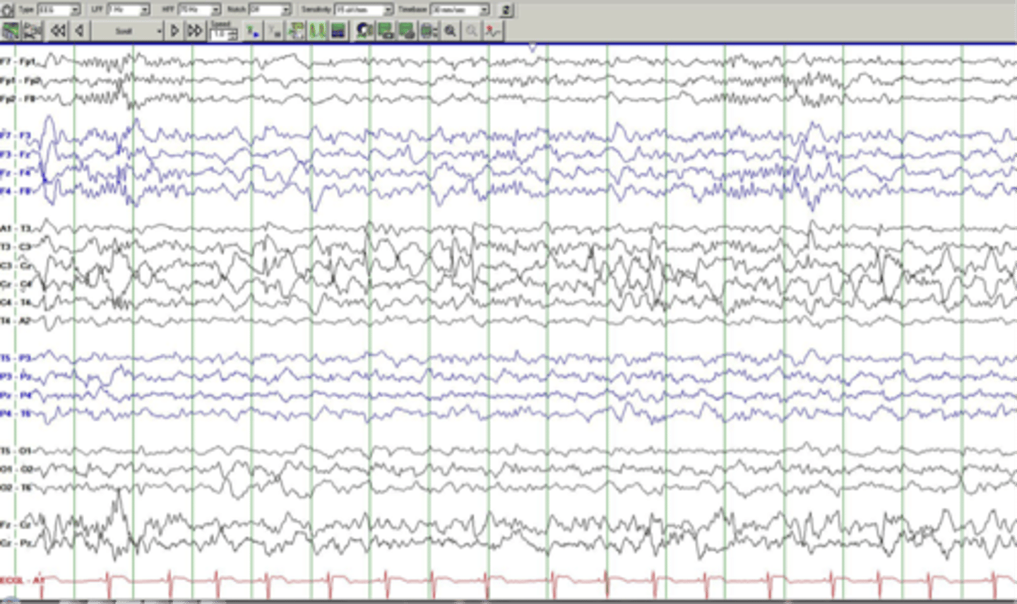 <p>period of time around a stimulus that is pulled out for analysis</p>