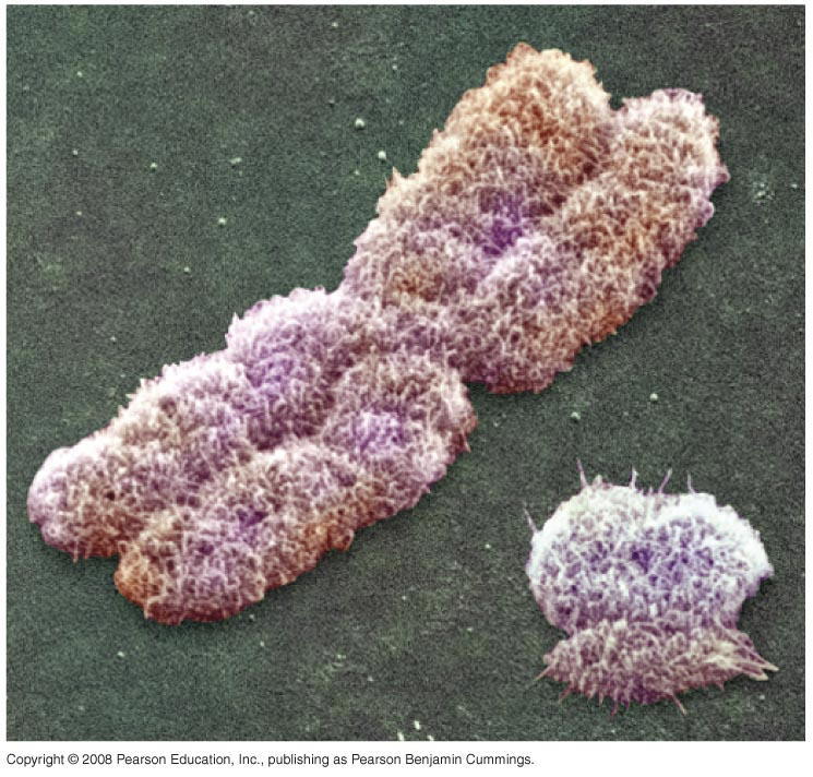 SRY gene lies on the Y chromosome