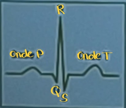<ul><li><p>Fréquence</p></li><li><p>régularité</p></li><li><p>Synchronicité des excitations des oreillettes et des ventricules</p></li></ul><p></p>