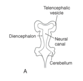 <p>Telencephalic vesicles</p>