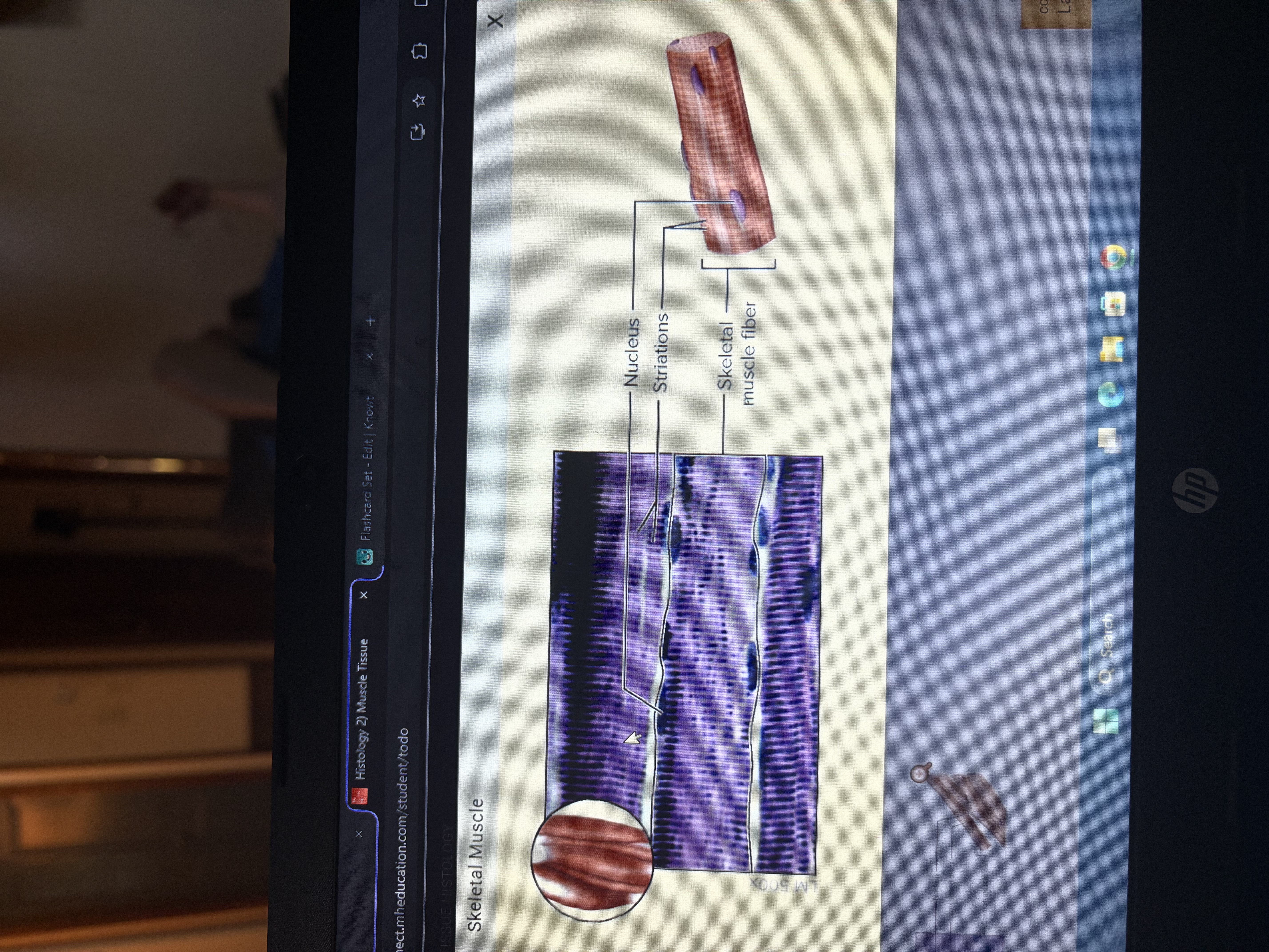 <p>Attaches to bone to skin</p><p>Cells are long striated cylindrical cells and multinucleate</p><p>Function- voluntary movement of skeletal muscle</p>