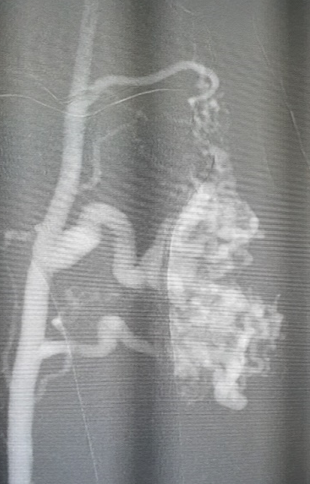 term image